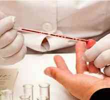 Înclinația pentru a determina boala altsgymera test de sânge