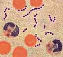 Infecții streptococice