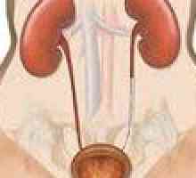 Ureterostegnosis