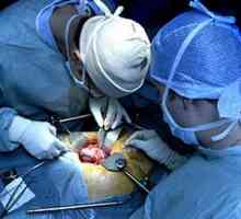 Transplantul de rinichi (transplant de rinichi)