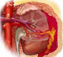 Leziuni ale sistemului urinar (rinichi, vezica urinara, uretra)