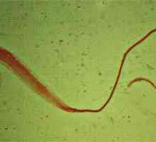 Trichuriasis (Whipworm)