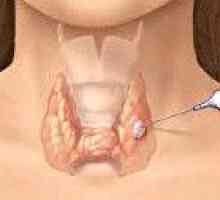 Nodurile și chisturi tiroidiene
