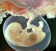 În Statele Unite, a ridicat o interdicție privind cercetarea de sprijin a embrionilor de stat