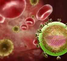 Infecției cu HIV și SIDA