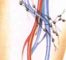 Umflarea ganglionilor limfatici din regiunea inghinala la bărbați și femei
