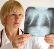 OMS avertizează în legătură cu revenirea tuberculozei