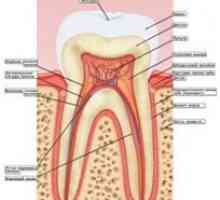 Boli ale gingiilor: gingivita, periodontita (boala de mestecat), boala parodontală