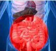 Sângerări gastro-intestinale