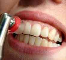 Placa dentară (igiena dentară)