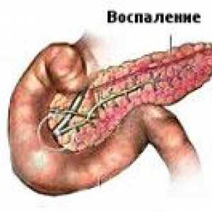 Pancreatita biliară