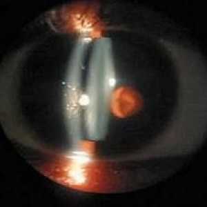 Ochii biomicroscopie