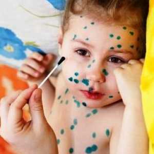 Ce se poate frotiu erupții cutanate de varicela la copii în afară de chestii verzi?
