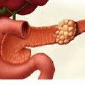 Tumorile benigne ale pancreasului