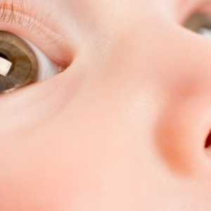 Infecții oculare la copii
