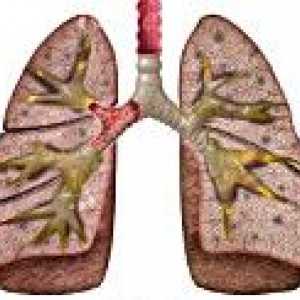Pneumonie cronică