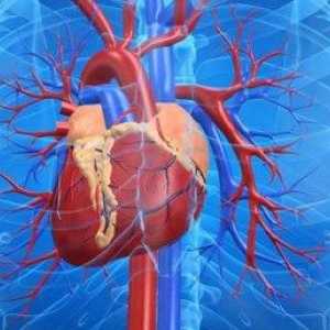 Insuficiență cardiacă cronică: simptome, tratament