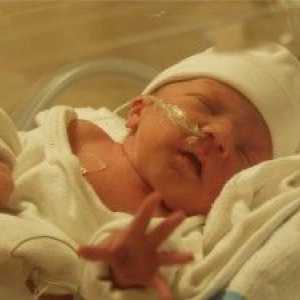 Ischemia cerebrală la nou-nascuti