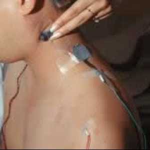 Electromiografia (EMG)