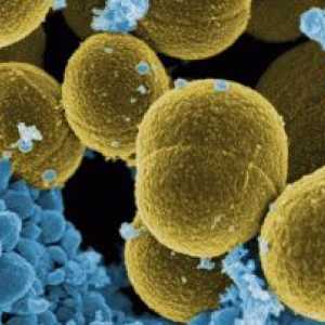 Cum este Staphylococcus aureus