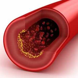 Cum de a reduce colesterolul din sânge?