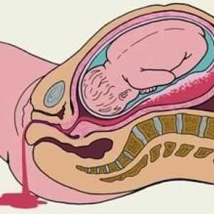 Sangerarea in timpul sarcinii in stadiile timpurii și târzii