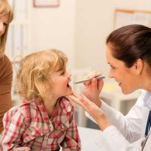 Tratamentul mononucleozei infecțioase la copii