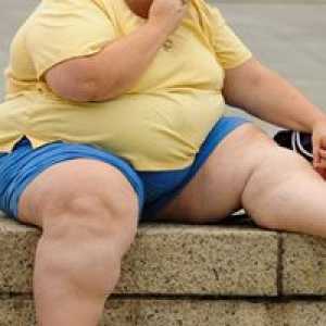 Persoanele cu obezitate adesea răniți în industria prelucrătoare