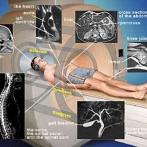 Imagistica prin rezonanta magnetica (IRM). Indicații, contraindicații, RMN