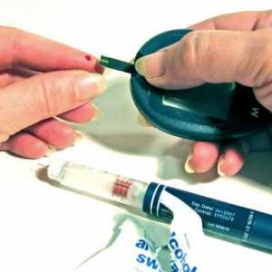 Norma în condiții de repaus alimentar de insulină din sânge. Efectul insulinei și a metodelor de…