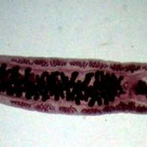 Opisthorchiasis (boala lui Vinogradov)