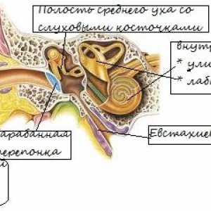 Otita (infecție a urechii)