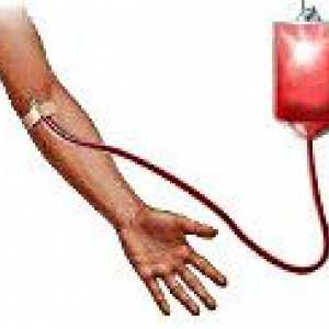 Complicații post-transfuzie