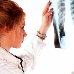 Simptomele cancerului pulmonar la un stadiu incipient