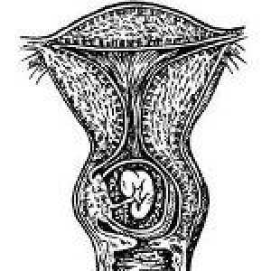 Sarcina de col uterin