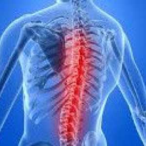 Arahnoidită spinării