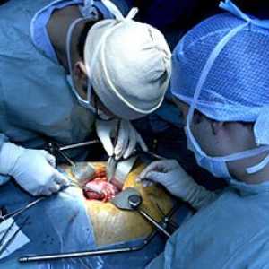 Transplantul de rinichi (transplant de rinichi)