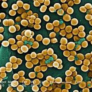 Staphylococcus aureus în gât