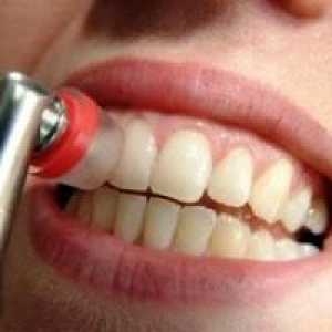 Placa dentară (igiena dentară)